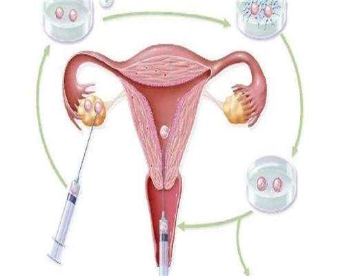 三代试管助孕：解析孕期NT检查，高龄及试管婴儿人群尤为关键