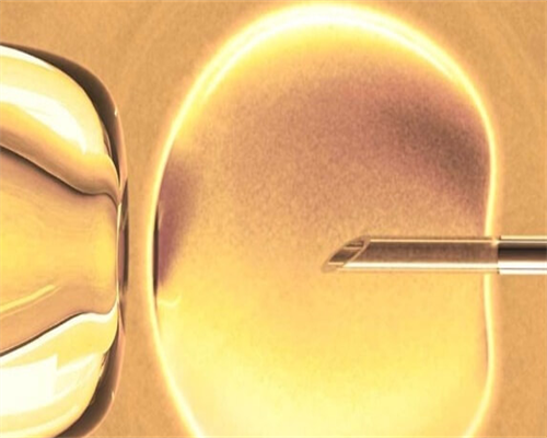 圆梦代孕圆梦，世纪助孕费用解析