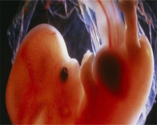 柬埔寨试管助孕生子费用揭秘：了解助孕之旅的成本