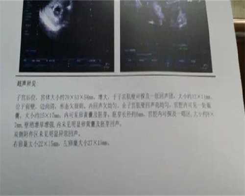 国外代妈试管婴儿：六大建议助您缓解压力